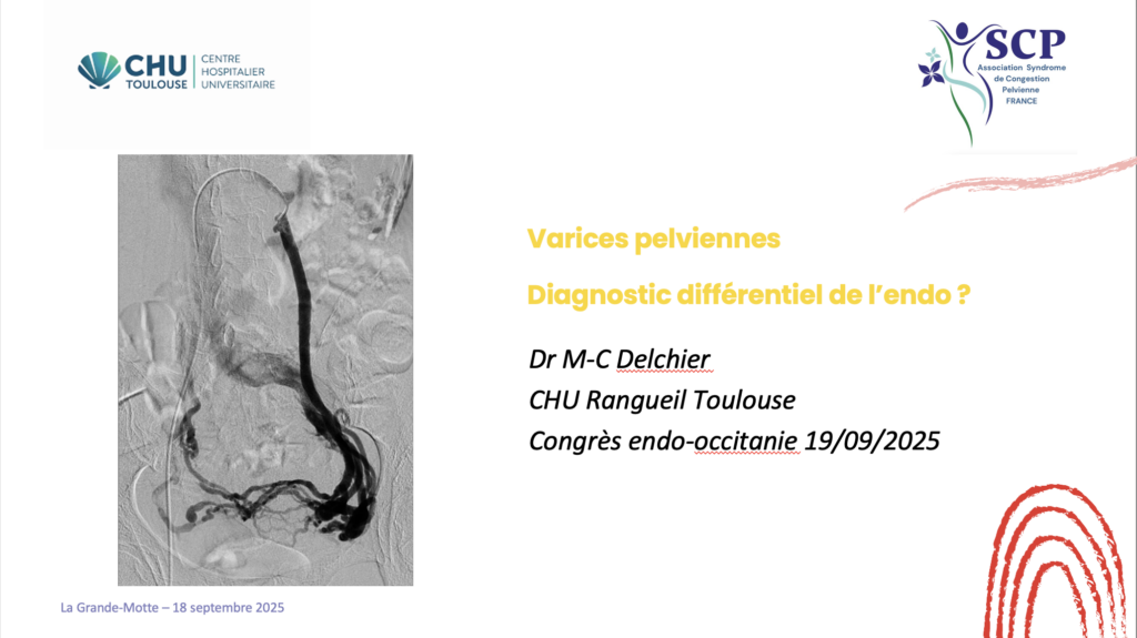 diagnostic différentiel